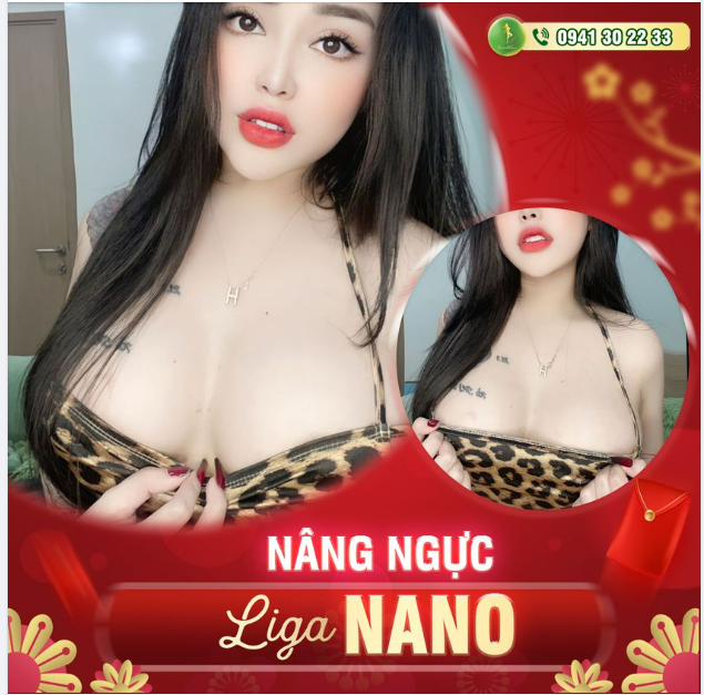 KHÁCH HÀNG LUÔN TIN TƯỞNG LỰA CHỌN GIẢI PHÁP NÂNG V1 LIGA NANO