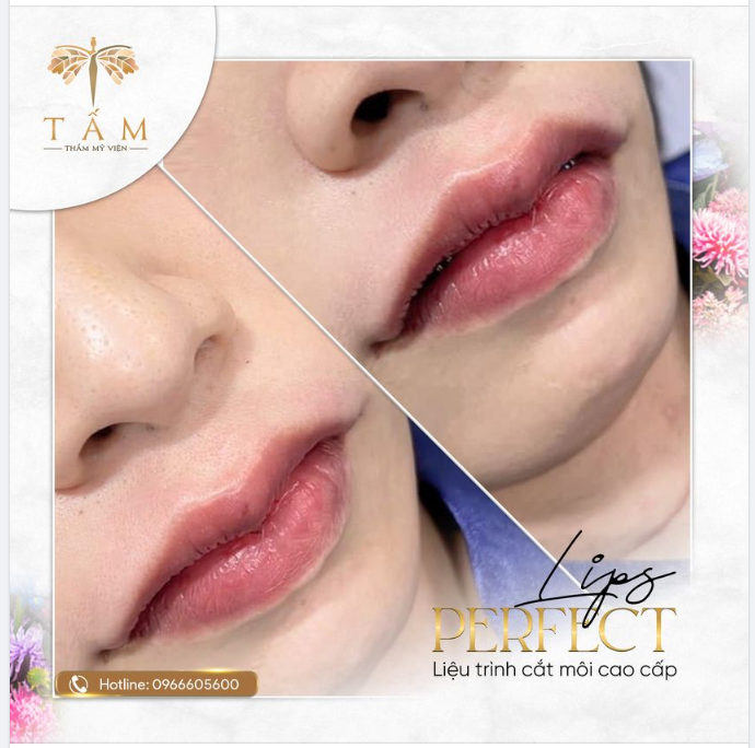 Mong muốn 1 đôi môi tim như ý nhưng chưa biết làm cách nào