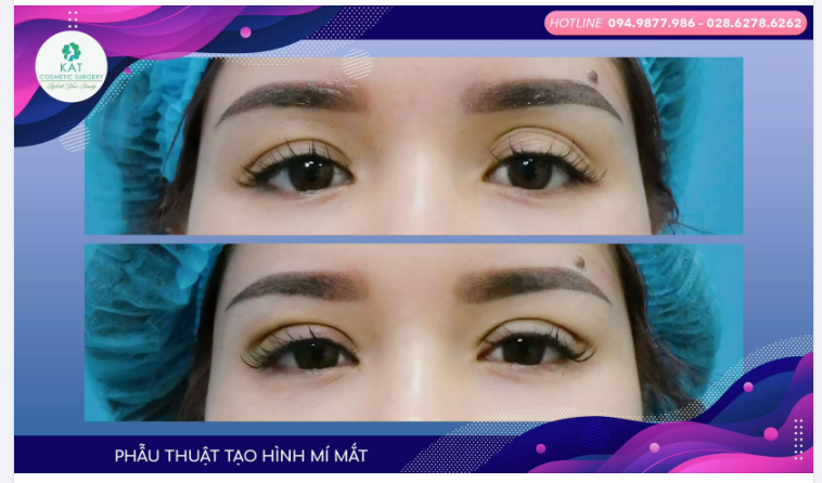 Ai có thể không see tình khi nhìn thấy đôi mắt hai mí long lanh tròn xoe như thê này ​​​​​​​.