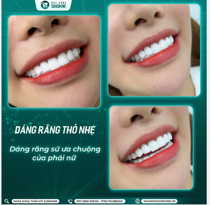 Vài năm trở lại đây xu hướng tạo dáng răng thỏ đang “làm mưa làm gió” ở giới trẻ.