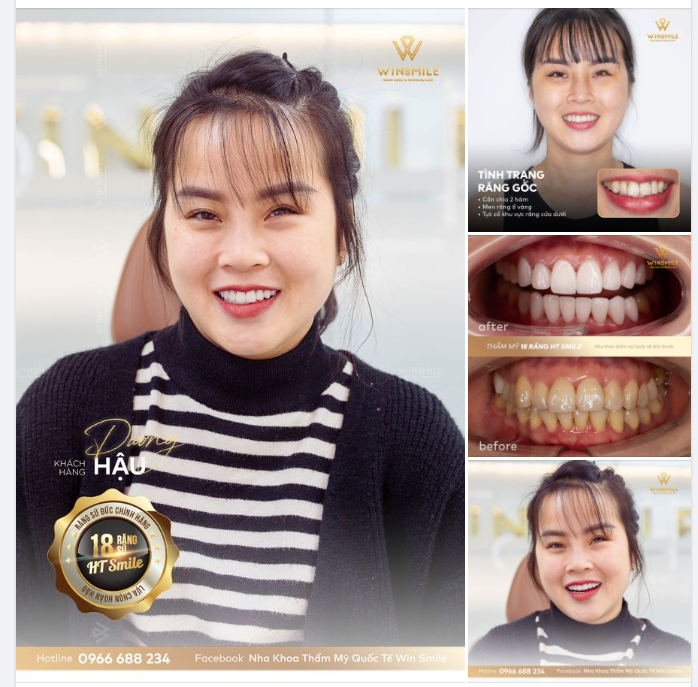 HACK TUỔI CỰC ĐỈNH VỚI NỤ CƯỜI MỚI TẠI WIN SMILE