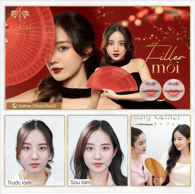 Bạn khách Thanh Thư trước đây sở hữu dáng môi mỏng, lệch khiến gương mặt thiếu cân đối.