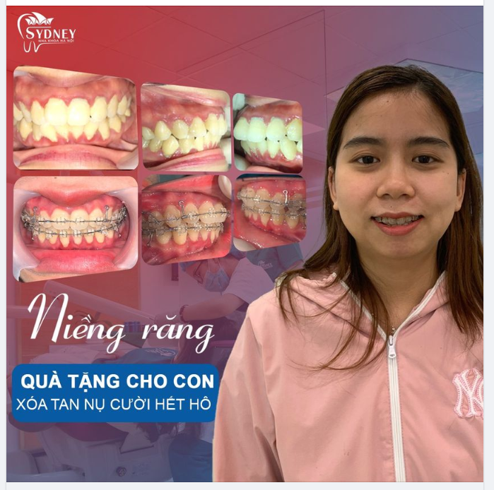 Một nụ cười bằng mười hạnh phúc