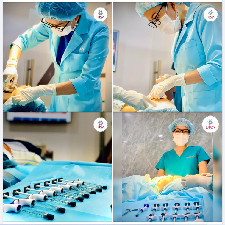 TIÊM FILLER MD CODES: ĐIỀU TRỊ CHẢY XỆ HIỆU QUẢ, KẾT QUẢ THẤY NGAY SAU KHI THỰC HIỆN