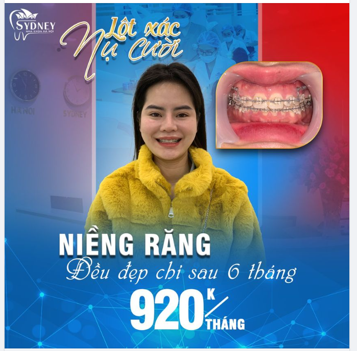 Một nụ cười mới vào đầu năm mới sẽ giúp khởi sắc một năm nhiều thành công mới.