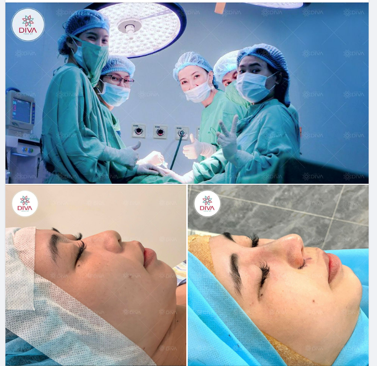 BẠN CÓ MUỐN SỞ HỮU DÁNG MŨI CAO THANH THOÁT, HÀI HÒA NHƯ THẾ NÀY ĐÓN TẾT?