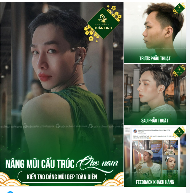 NÂNG MŨI CẤU TRÚC CHO NAM - KIẾN TẠO DÁNG MŨI ĐẸP HOÀN HẢO!