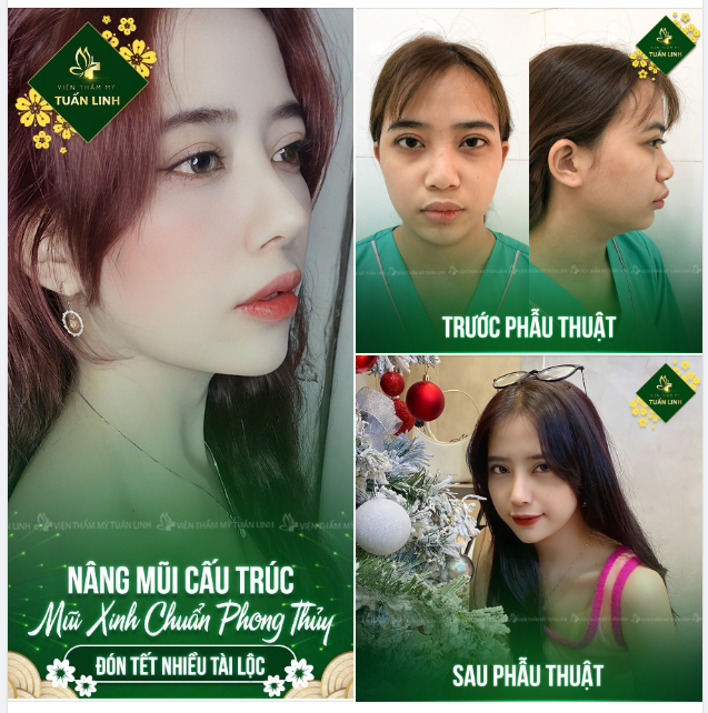 MŨI XINH HỢP PHONG THỦY - ĐÓN TẾT NHIỀU TÀI LỘC.