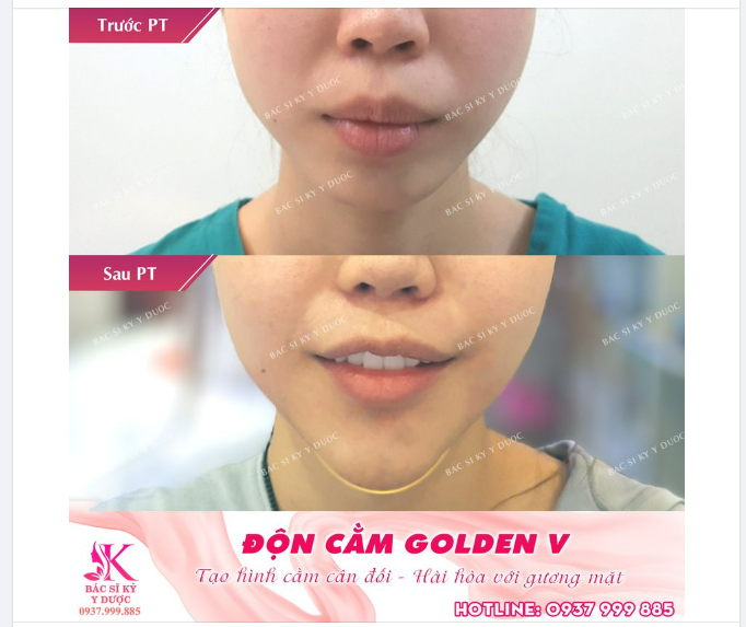 Bí quyết có gương mặt đẹp chuẩn tỉ lệ vàng