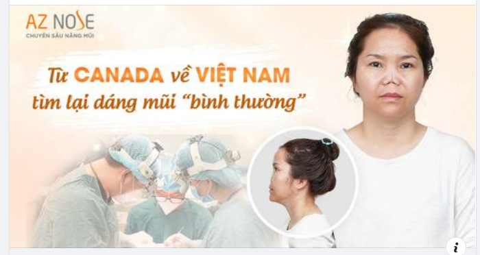 Sau 4 lần phẫu thuật không thành công, chị N.T.B. chỉ khát khao được sở hữu lại dáng mũi “cơ bản” như bao người...