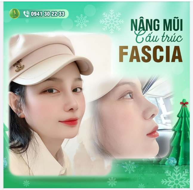 THANH HƯƠNG NỔI BẬT VỚI DÁNG MŨI CAO HÚT HỒN