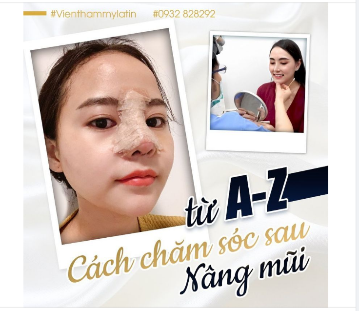CHĂM SÓC SAU NÂNG MŨI ĐỂ NHANH LÀNH THƯƠNG, NHỮNG ĐIỀU BẠN CẦN BIẾT!