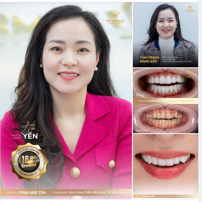 NỤ CƯỜI LÀ TRANG PHỤC ĐẮT GIÁ NHẤT MÀ BẠN CÓ THỂ MANG!
