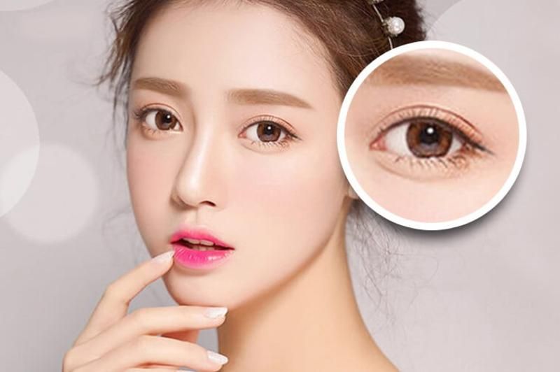 Nhược điểm đôi mắt 1 mí nhỏ, chảy xệ được khắc phục với công nghệ cắt mí hiện đại