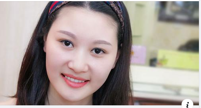Sau khi tẩy trắng răng cần tuân thủ