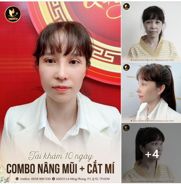 COMBO NÂNG MŨI + CẮT MÍ KHAI XUÂN KHAI SẮC CHỈ SAU 10 NGÀY