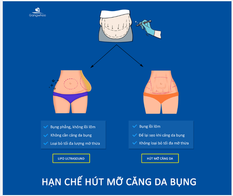 BẠN ĐÃ BIẾT NHỮNG HẠN CHẾ CỦA HÚT MỠ CĂNG DA BỤNG
