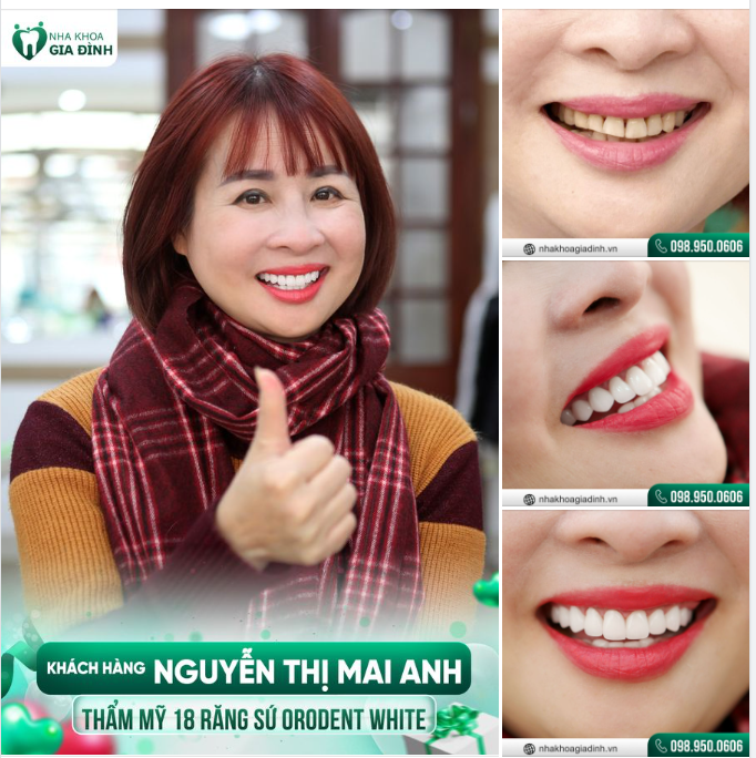 CÓ HÀM RĂNG ĐẸP, NỤ CƯỜI RẠNG RỠ BẠN MUỐN LÃO HÓA CŨNG KHÔNG ĐƯỢC