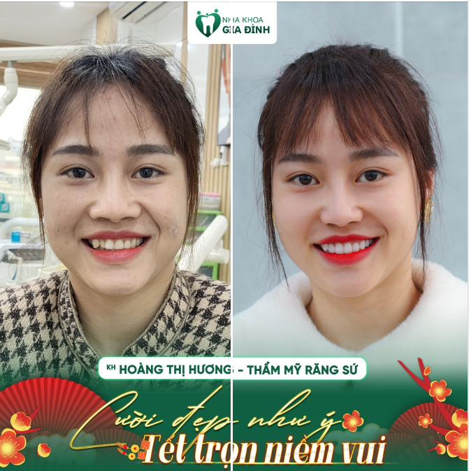 NỤ CƯỜI MỚI – ĐÓN XUÂN TỚI
