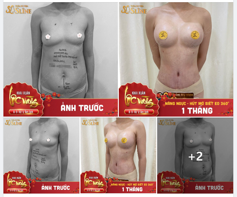 KIẾN TẠO BODY  VỚI "COMBO SIÊU VIP"