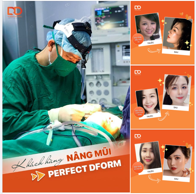 Nếu có ai hỏi: "NÂNG MŨI PERFECT DFORM CÓ ĐÁNG ĐỂ THỰC HIỆN KHÔNG?"