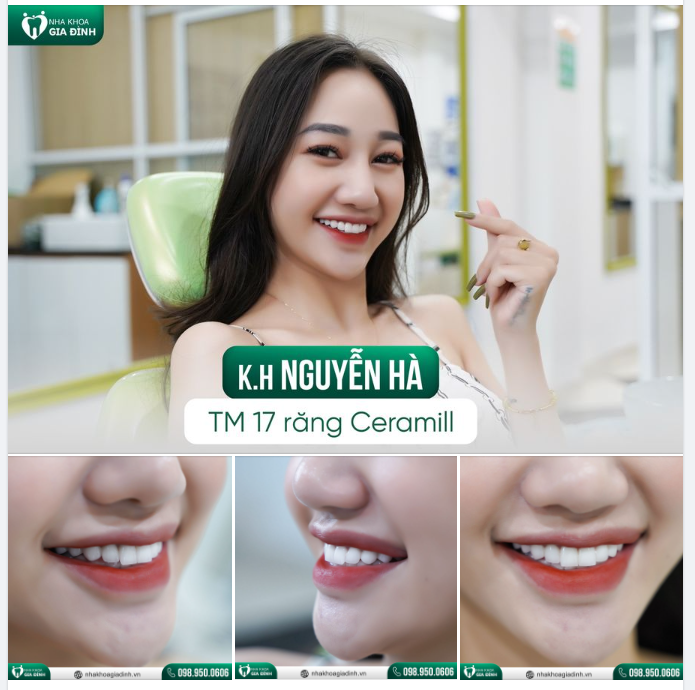 CUNG RĂNG NHƯ Ý – NỤ CƯỜI MÊ LY