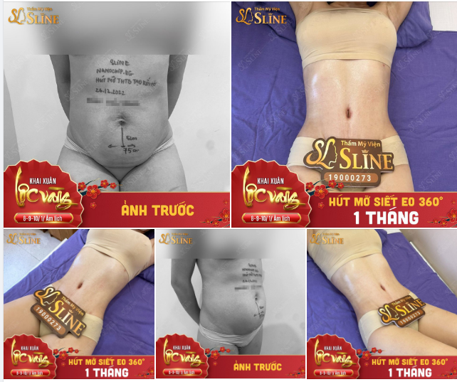 ĐIÊU KHẮC BODY "360°"