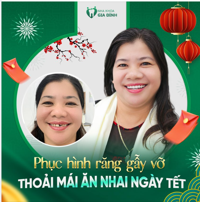 HOÀN THIỆN NỤ CƯỜI – PHỤC HỒI ĂN NHAI