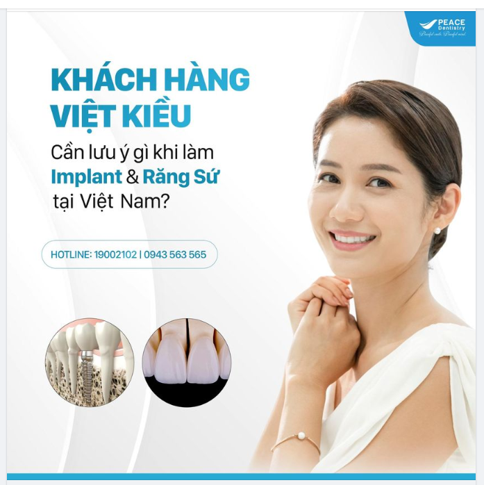 5 LƯU Ý ĐẶC BIỆT VỚI KHÁCH HÀNG VIỆT KIỀU KHI LÀM  Implant và  răng sứ TẠI VIỆT NAM