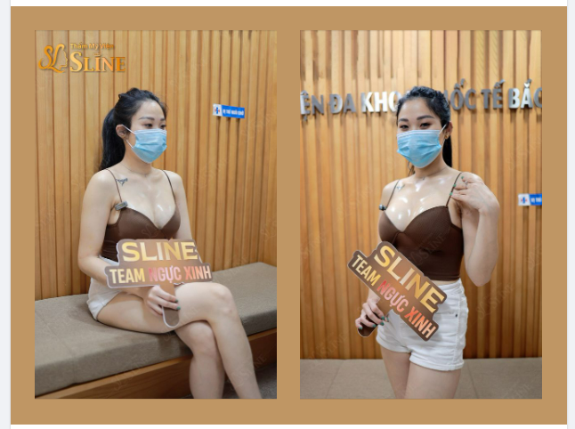 Ngực xinh sau 14 ngày đặt túi Nanochip Ergonomix.