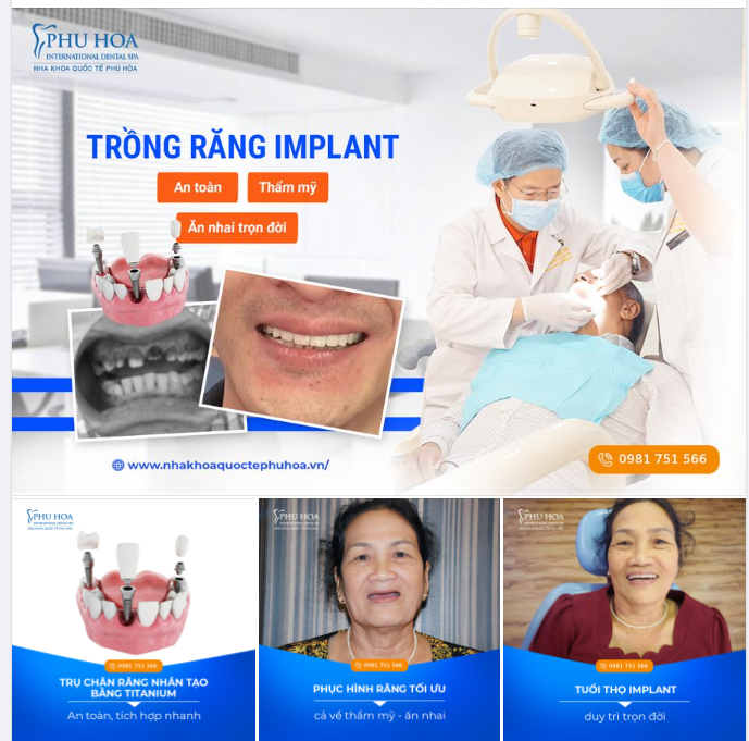 TRỒNG RĂNG IMPLANT – AN TOÀN, THẨM MỸ, ĂN NHAI TRỌN ĐỜI