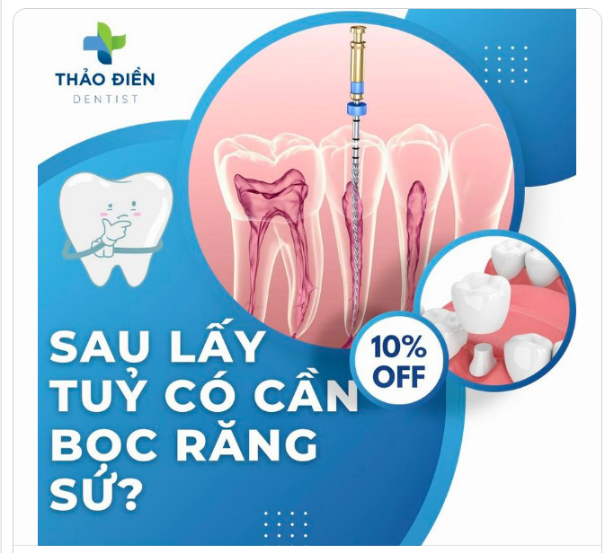 CÓ NÊN BỌC SỨ SAU KHI ĐIỀU TRỊ TỦY RĂNG?