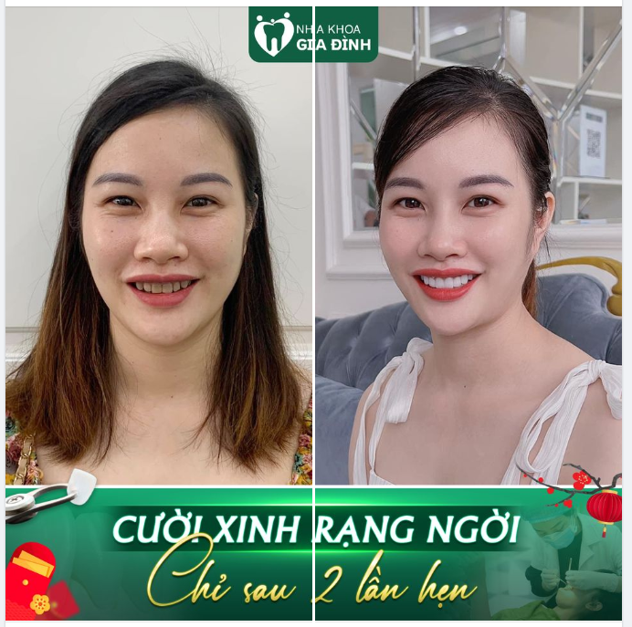 ĐẶT NIỀM TIN ĐÚNG CHỖ - NHẬN NỤ CƯỜI ĐÁNG MƠ