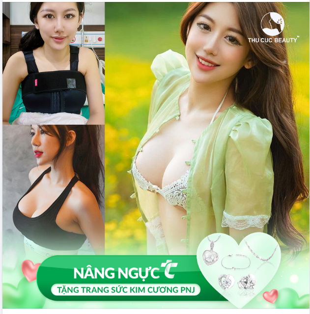 Tròn đầy, sexy, tăng size như ý nhờ Nâng ngực TC