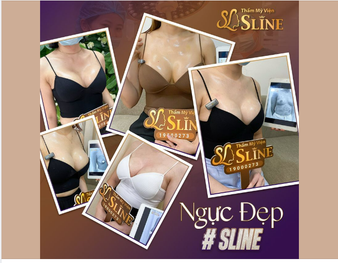 NGỰC ĐẸP cùng SLINE.