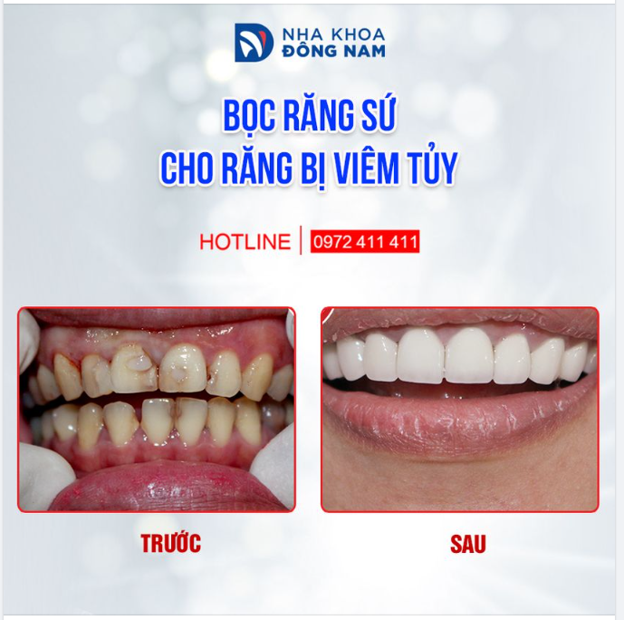 NỤ CƯỜI KHỞI SẮC - ĐẮC LỘC KHAI XUÂN
