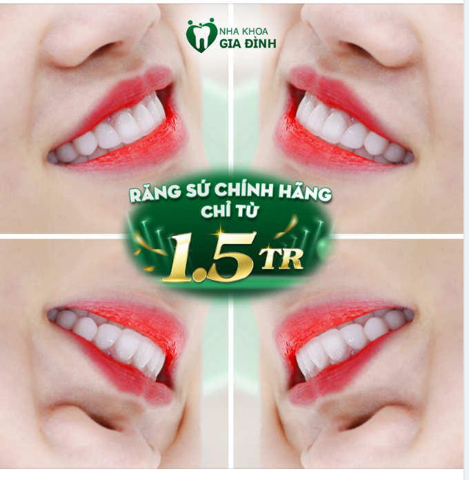 LÀM RĂNG ĐẸP VÀ CHẤT LƯỢNG HÃY ĐẾN VỚI NHA KHOA GIA ĐÌNH