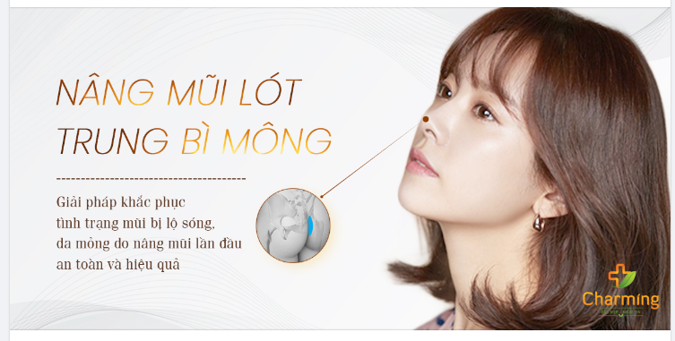 NÂNG MŨI VỚI TRUNG BÌ MÔNG: SỬA MŨI KHÔNG CẦN NÂNG CẤU TRÚC