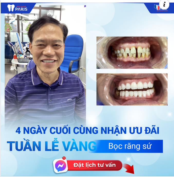 CHỈ CÒN 4 NGÀY CUỐI CÙNG NHẬN ƯU ĐÃI TUẦN LỄ VÀNG
