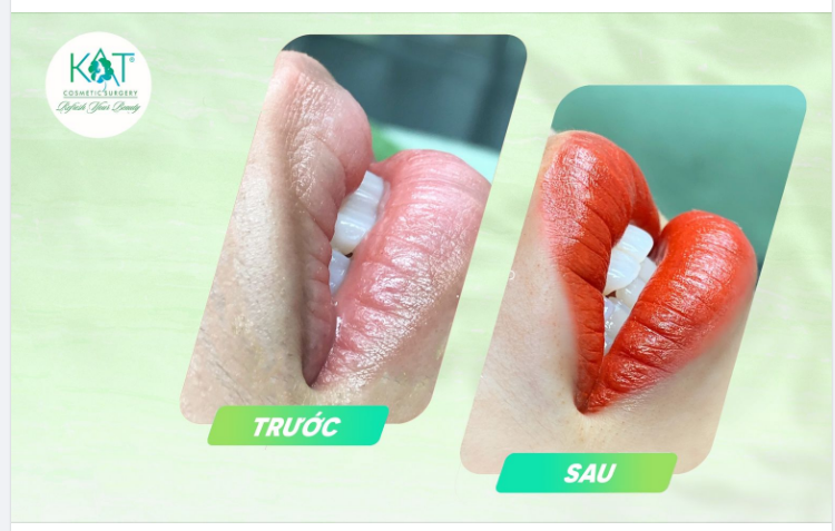 MÔI XINH LUNG LINH - LÔI CUỐN ÁNH NHÌN