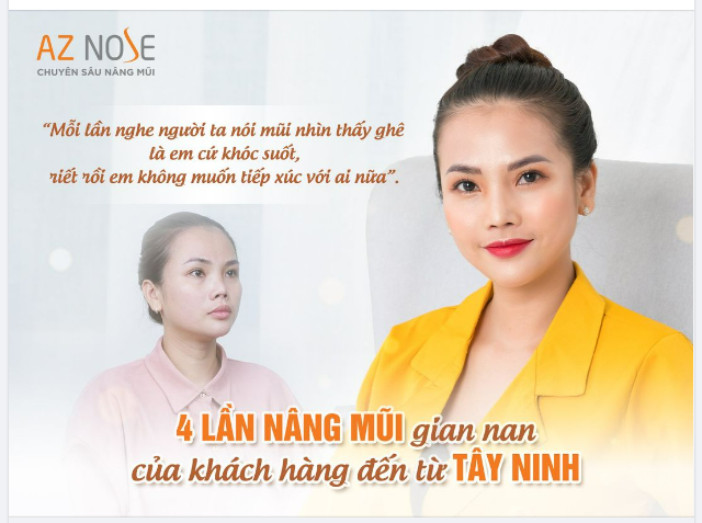 “Mình chỉ mong có dáng mũi bình thường như bao người...”