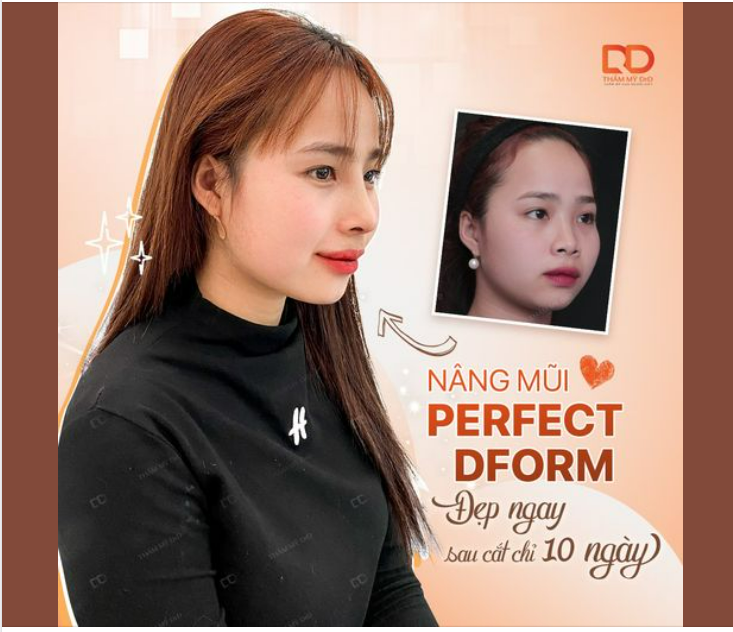 CÓ MỘT SỰ THAY ĐỔI KHÔNG HỀ NHẸ