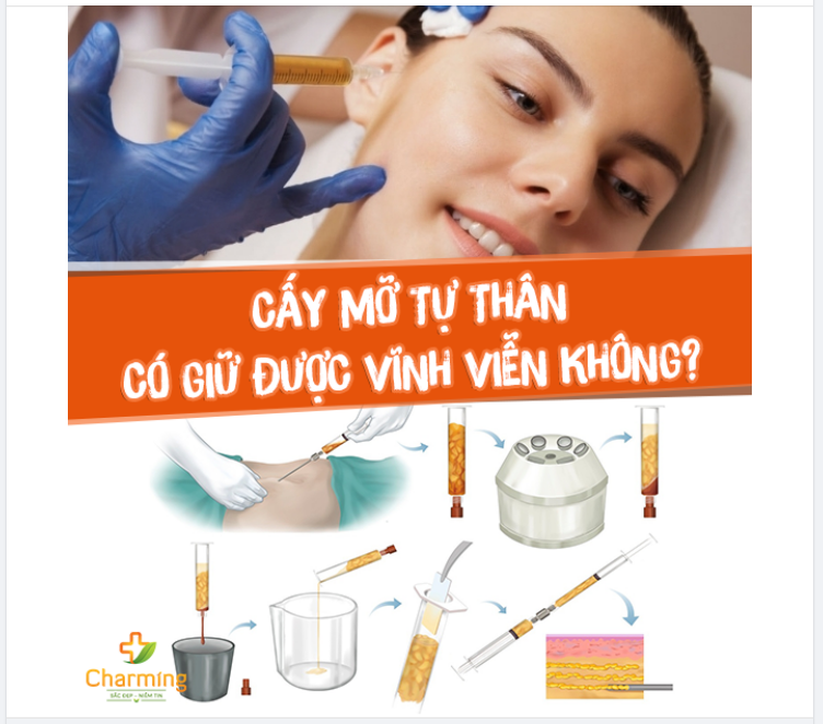 HIỆU QUẢ CẤY MỠ TỰ THÂN CÓ GIỮ ĐƯỢC VĨNH VIỄN KHÔNG?