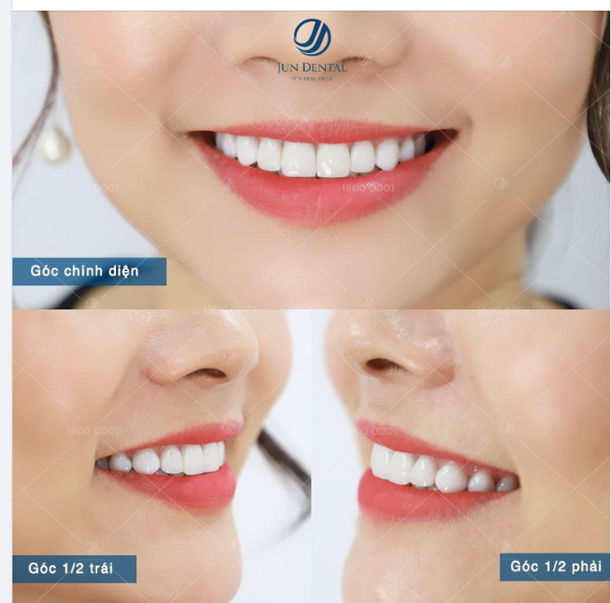 THAY LỚP ÁO MỚI CHO NỤ CƯỜI ĐỂ TÔN LÊN NÉT ĐẸP HIỆN ĐẠI MÀ SANG TRỌNG