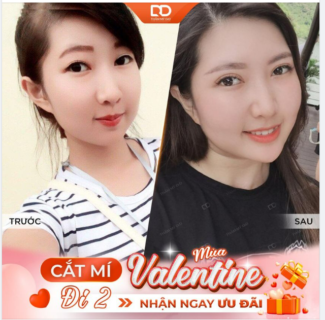 CẮT MÍ MÙA VALENTINE - ĐI 2 NHẬN NGAY ƯU ĐÃI