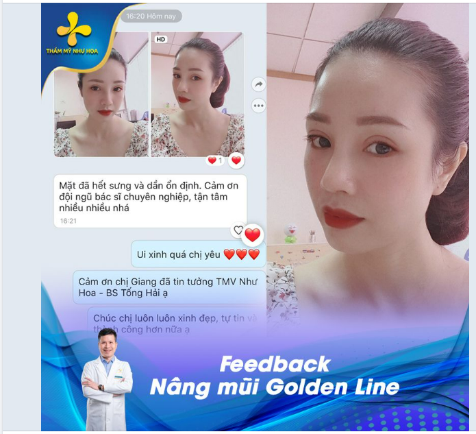 NÂNG MŨI KHÔNG CHỈ ĐỂ XINH, NÂNG MŨI LÀ ĐỂ CHỤP ẢNH KHÔNG KIÊNG GÓC NÀO