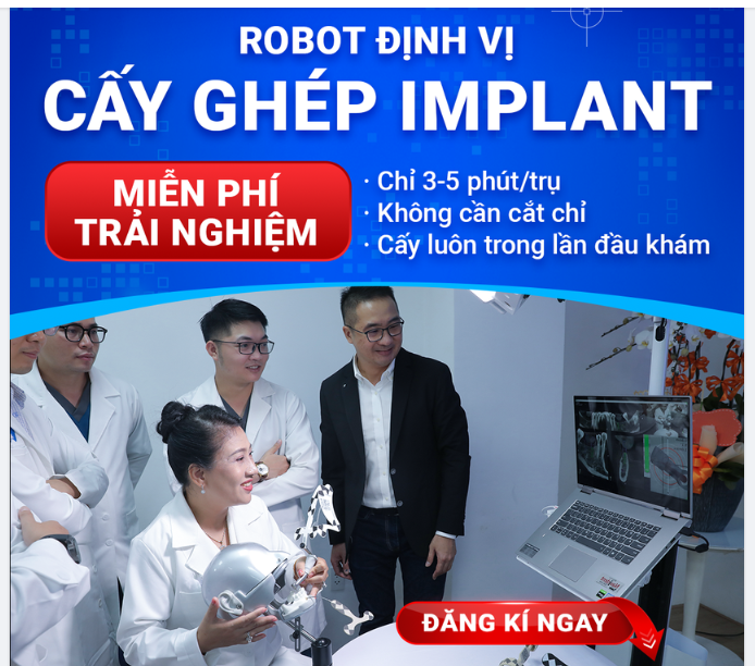 ️[MIỄN PHÍ 100%] CẤY GHÉP IMPLANT ĐỊNH VỊ