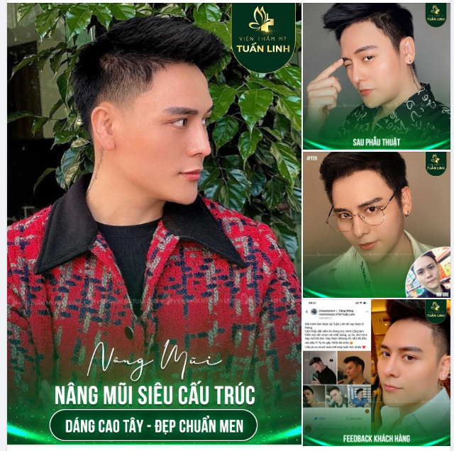 MŨI CAO TÂY CHUẨN HOTBOY!!