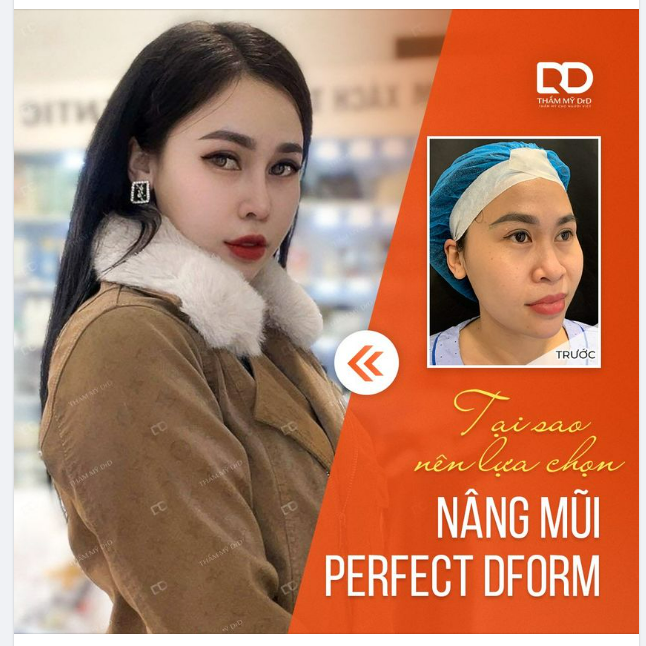 TẠI SAO NÊN LỰA CHỌN NÂNG MŨI PERFECT DFORM?