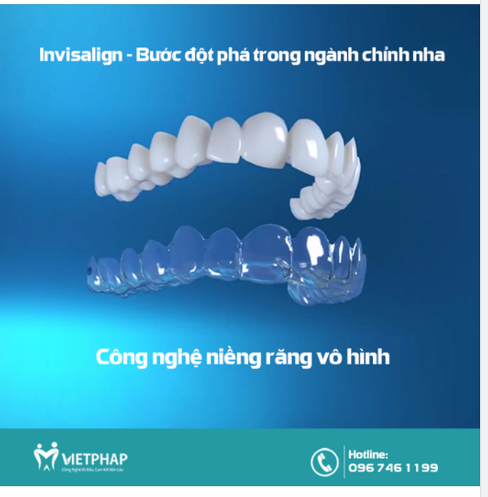 Niềng răng không mắc cài Invisalign - Cuộc cách mạng đột phá trong chỉnh nha
